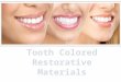 Tooth colored restorative materials