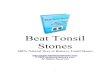 Beat Tonsil Book