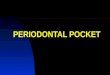 1 - The Periodontal Pocket