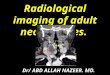 Presentation1.pptx, radiological imaging of adult neck masses