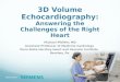 3D Volume Echocardiography: Answering the Challenges of the Right Heart