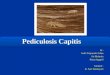 Pediculosis Capitis 22222
