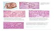 Endocrine Pathology p33-47