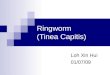 Ringworm (Tinea Capitis)