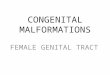 Congenital malformations rs