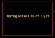 Thyroglossal Duct Cyst