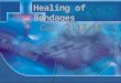 130811 healing of bondages col. 2.13 15