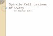 Spindle Cell Lesions of Ovary