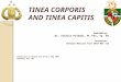 Tinea Corporis and Tinea Capitis