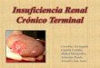 Insuficiencia renal crónico terminal