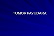 1 Tumor Payudara