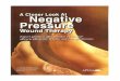 Negative Pressure Wound Therapy