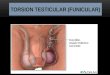Urologia Hidrocele Torsion Varicocele