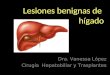 Lesiones benignas de hígado Dra. Vanessa López Cirugía Hepatobiliar y Trasplantes