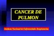 CANCER DE PULMON Instituto Nacional de Enfermedades Respiratorias