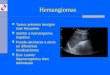 Hemangiomas Tumor primario benigno más frecuente Similar a hemangioma hepático Puede asociarse a otros en diferentes localizaciones Eco: Lesión hiperecogénica