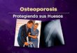 Osteoporosis Protegiendo sus Huesos. Una de cada tres mujeres mayores de 50 años sufre de osteoporosis Una de cada tres mujeres mayores de 50 años sufre
