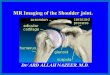 Presentation1.pptx. shoulder joint