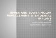 Upper and lower molar replacement with dental implant