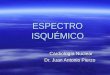ESPECTRO ISQUÉMICO Cardiología Nuclear Dr. Juan Antonio Pierzo
