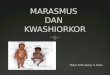 PP Marasmus Dan Kwashiorkor