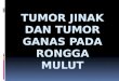 Tumor Jinak Dan Tumor Ganas Pada Rongga Mulut