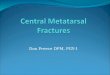 Dan Preece DPM, PGY-1. Stress Fx Frequency /Distribution: -second metatarsal 52% -third metatarsal 35% -first metatarsal 8% -fourth and fifth metatarsals