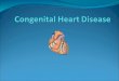 Acyanotic Congenital Heart Disease Left-to-Right Shunt Lesions Atrial Septal Defect (ASD) Ventricular Septal Defect (VSD) Atrioventricular Septal Defect