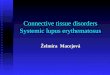 Connective tissue disorders Systemic lupus erythematosus Želmíra Macejová