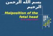 بسم الله الرحمن الرحيم Malposition of the fetal head By dr. sallama kamel