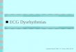 ECG Dysrhythmias Updated March 2006: D. Tucker, RPh, BCPS