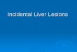 Incidental Liver Lesions