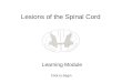 Lesions of the Spinal Cord Learning Module Click to Begin