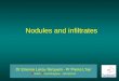 Nodules and infiltrates. Pulmonary TB, main radiological aspects and differential diagnoses Pulmonary TB, main radiological aspects and differential diagnoses