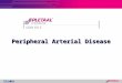 Slide Kit 2 Peripheral Arterial Disease. 24.7% 3.8% 11.8% 29.9% 3.3% 7.4% 19.2% Coexisting Vascular Diseases CAD CVD PAD Lancet. 1996;348:1329–39 Atherothrombosis
