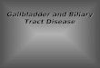 Gallbladder and Biliary Tract Disease. Cholelithiasis
