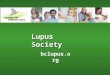 Bclupus.org Lupus Society. bclupus.org What is Lupus? It is an acute chronic autoimmune disease The immune system over-activates and misfires It can target
