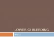 LOWER GI BLEEDING 4/6/11. LGIB  Distal to ligament of Treitz  Annual incidence rate of 20.5/100,000  Male predominance  Incidence of significant bleeding