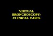 VIRTUAL BRONCHOSCOPY- CLINICAL CASES. Normal VB Viewsn 1st 4 images show normal carina, right upper and middle lobe bronchus, R lower lobe bronchus and