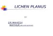 LICHEN PLANUS LICHEN PLANUS BY DR.MAHESH MATHUR, MD,DVD,DCP(UK)