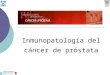 Inmunopatología del cáncer de próstata. Sistema inmunológico/inflamatorio y cáncer de próstata  ¿Participa el sistema inmunológico/ inflamatorio en la