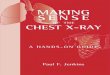Making Sense of Chest Xray a Hands on Guide