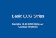 Basic ECG Strips NEW