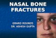 #Nasal Bone