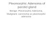 Pleomorphic Adenoma of Parotid Gland