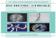 ISCHEMIC STROKE: AN ATLAS OF INVESTIGATION AND DIAGNOSIS