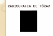 RADIOGRAFIA DE TÓRAX. Radiologia Torácica Incidências: 1. Postero-anterior: evitar a magnificação do coração e possibilita o posicionamento dos ombros