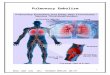 Pulmonary embolism ms