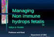 Managing Nonimmune hydrops fetalis