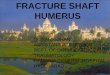 Humerus fracture